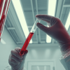 mano-con-guante-sujetando-tubo-de-ensayo-con-sangre-creatinina-baja-prueba-de-laboratorio